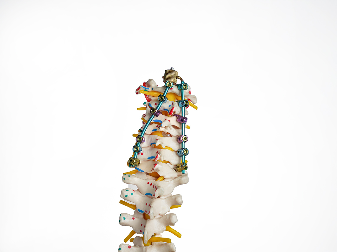 Cervical Fixation System